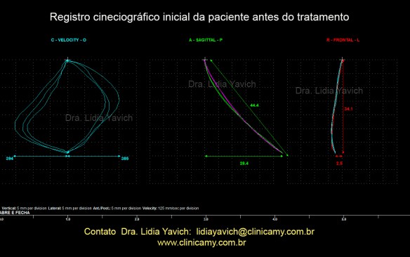 10 abre e fecha inicial