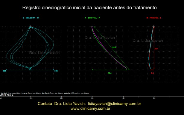 10 abre e fecha inicial