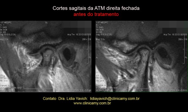 11 RNM INICIAL DIREITA FECH
