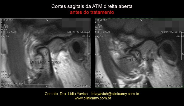 11B RNM INICIAL aberta dir