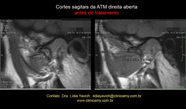 12B RNM INICIAL aberta dir