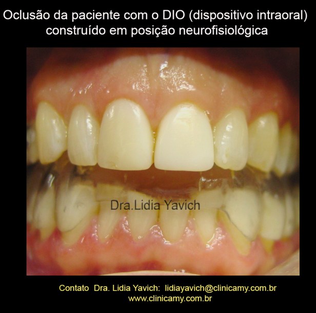 16A ortese inicial so frontal