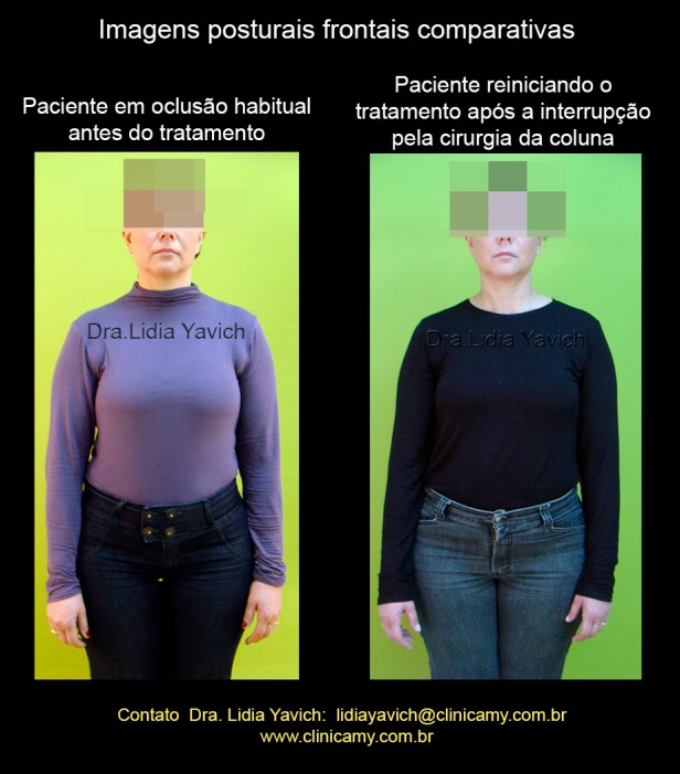 17 FOTO frontal reinicio de tratamento 1