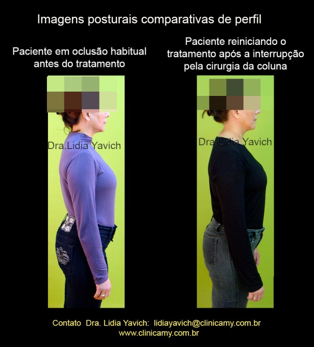 18 FOTO PERFIL reinicio de tratamento 2