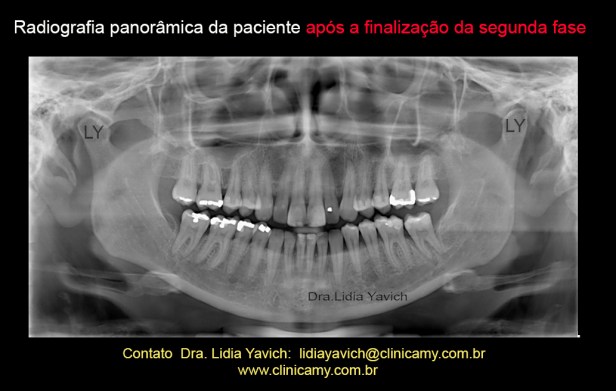 33 panoramica  final