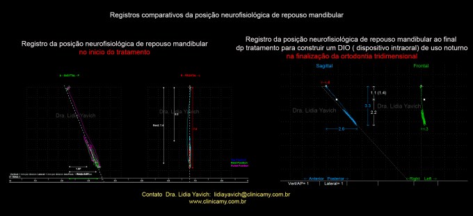 35 registro COMPARATIVOS