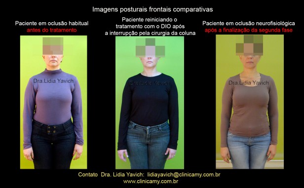 36 iimagens comparativas frontais