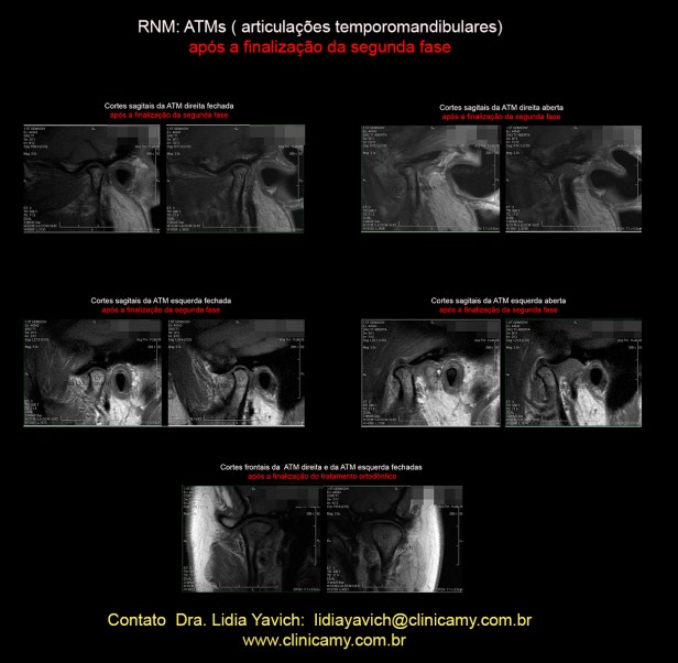 NOVA RESSONANCIAS FINAIS