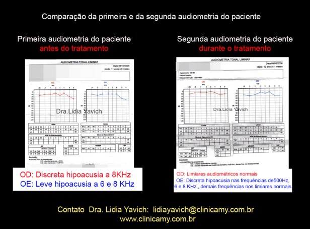 21 AUDIOMETRIA 1 e  2