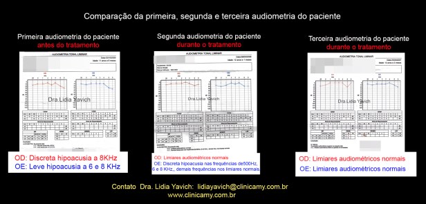 28 AUDIOMETRIA 1 e  2 e 3