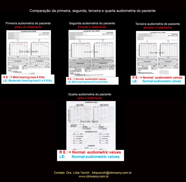 40 todas as audiometrias