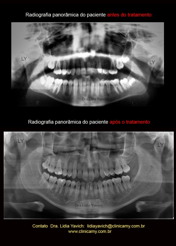 panoramicas comparativas