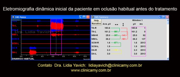 10 eletromiog dinamica inicial