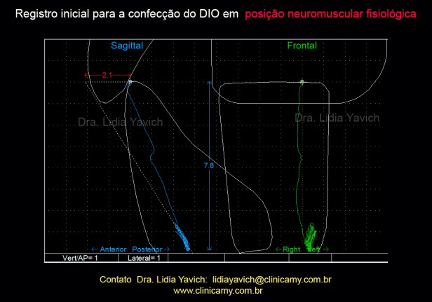 21A registro inicial para o DIO