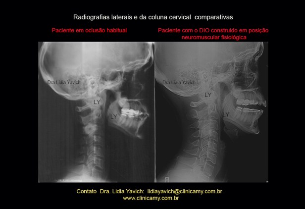 24 ct comparativas com dio