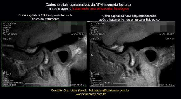 47 ress esqu comparativa 1