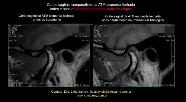 48 ress esqu comparativa 1