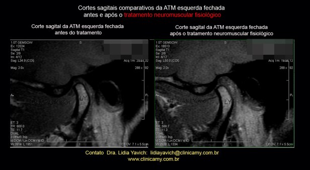 49 ress esqu comparativa 1