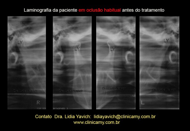 6 LAMINOGRAFIA INICIAL