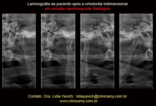 73 laminografias final