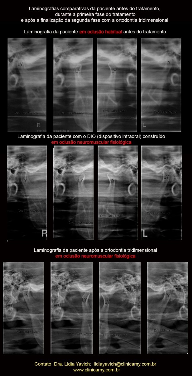 74 3 laminografias comparativas