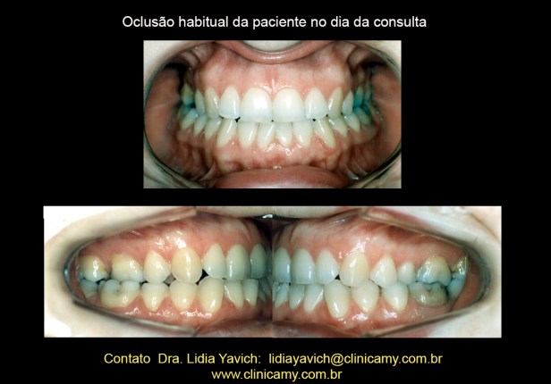 2 DENTES INICIAIS