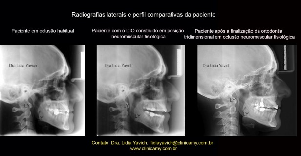 41 PERFIL 3 COMPARATIVAS