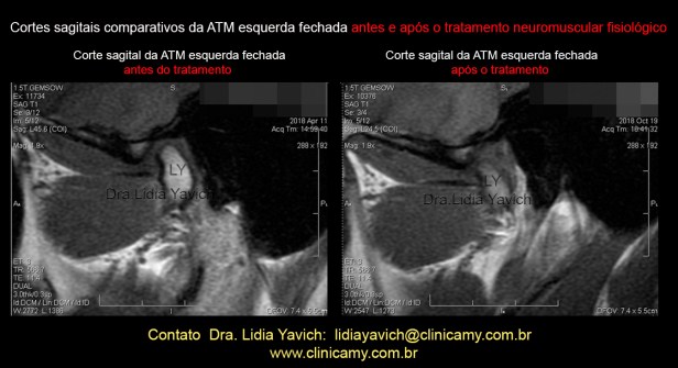 38 rnm comparativas 4