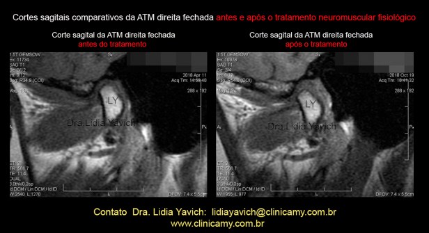 39 rnm comparativas 5