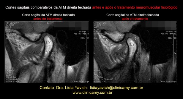 40 rnm comparativas 6