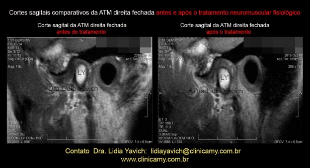 42 rnm comparativas 8