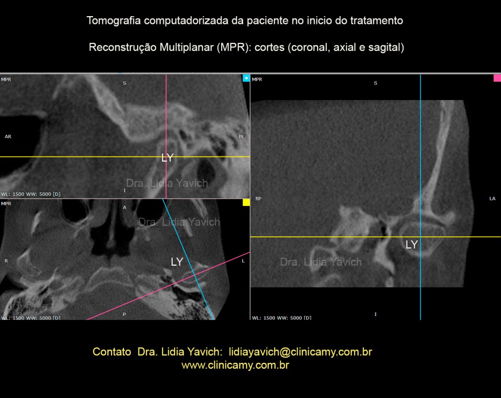 Esta imagem possuí um atributo alt vazio; O nome do arquivo é 8-ct-2017-esq-com-exos.jpg