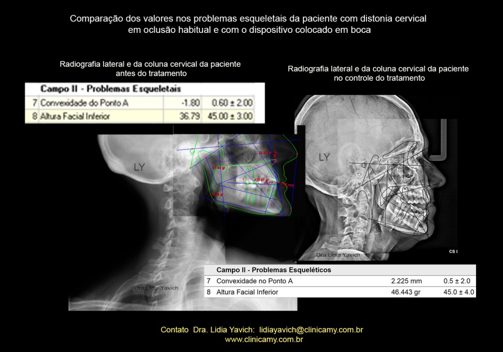 Essa imagem tem um atributo alt vazio; o nome do arquivo é trazados-valores-zz-1.jpg